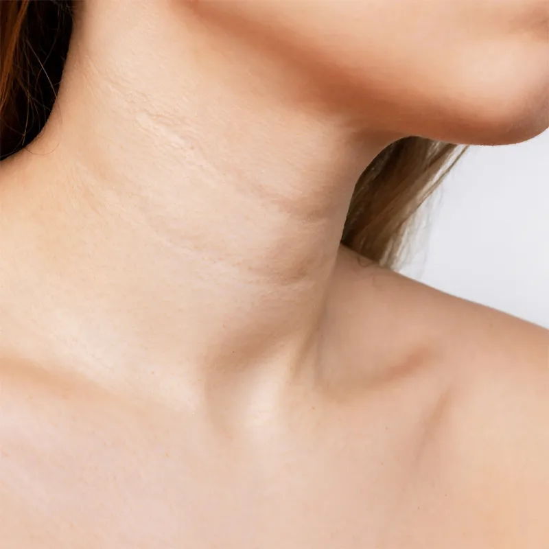 ansikt-hals-og-decollete