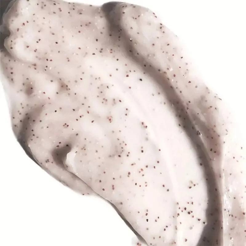 Alt du må vite om fet hodebunn 4