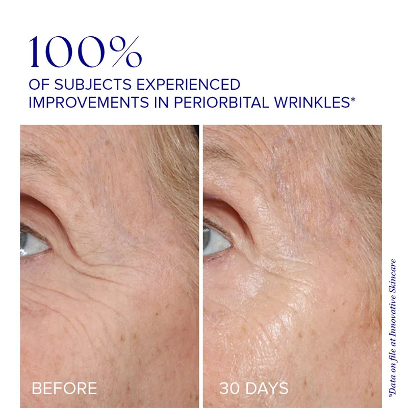 is-clinical-youth-eye-complex