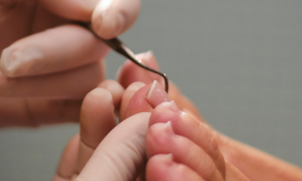 Hva er forskjellen på pedikyr og autorisert fotpleie?