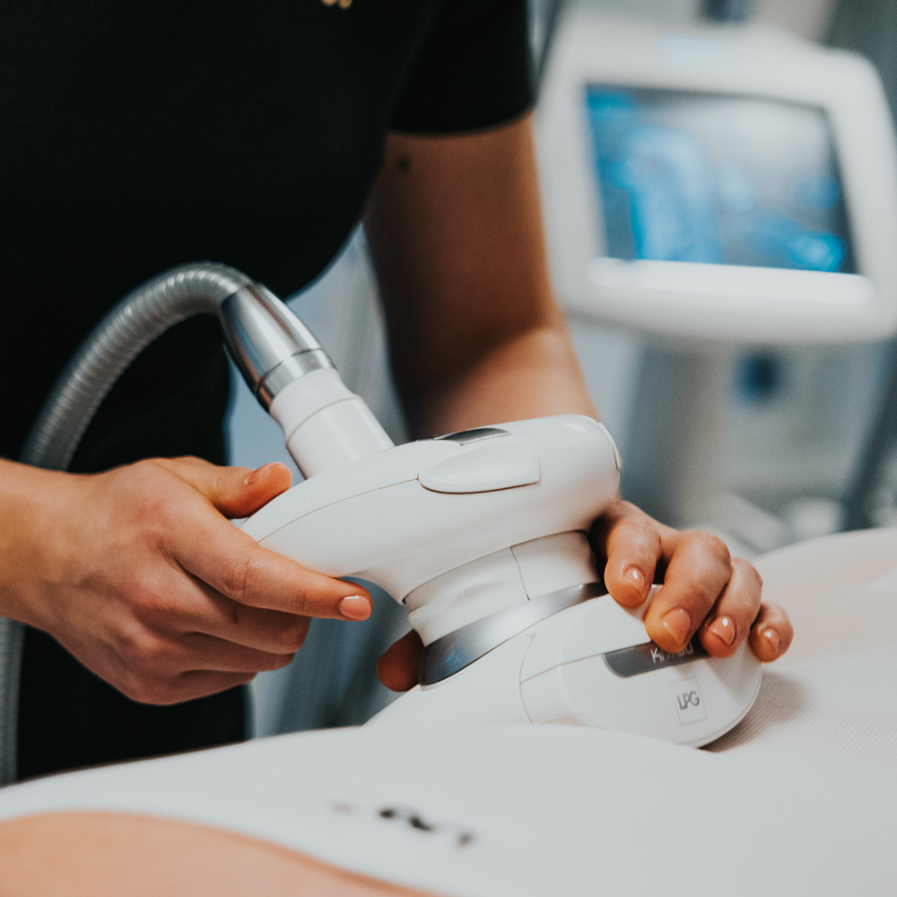 lpg lipomassage beths beauty