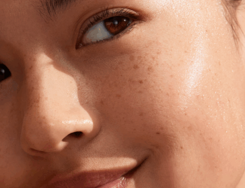 Ta vare på huden i vårsolen – her er tipsene