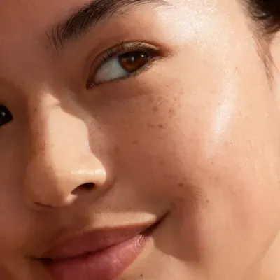 Ta vare på huden i vårsolen – her er tipsene